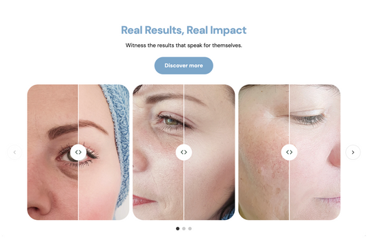 Tpt - Image comparison #3 - Tapita 